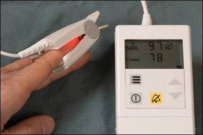 Mid-range handheld pulse oximeter.