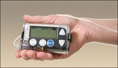 Insulin pump.