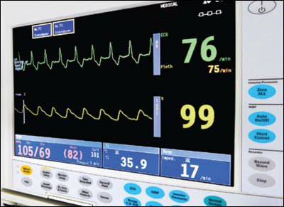 Figure 1. Patient monitor showing ECG and pulse oximetry readings.