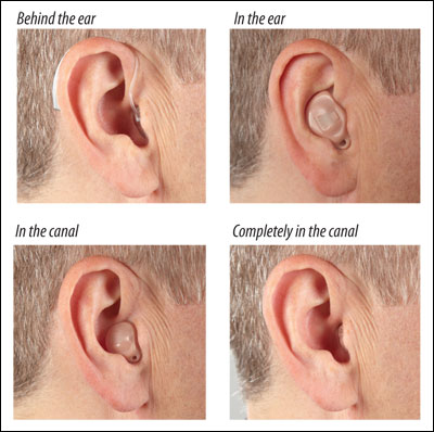 Behind the ear (BTE), in the ear (ITE), in the canal (ITC), and completely in the canal (CIC). Photos courtesy of Starkey Laboratories, Inc.