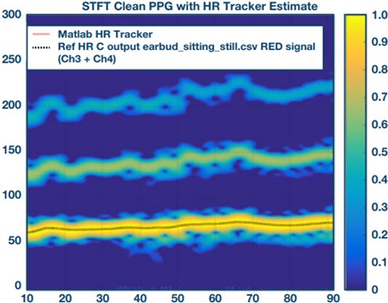 Summed data of four-channel measurement for standing still