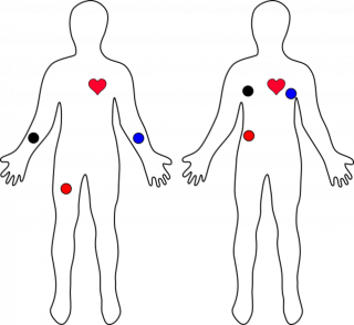 fig12